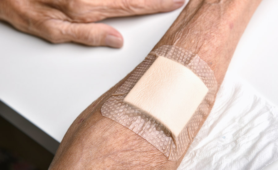 PSA Wound Dressing Adhesion and Skin Type: A Delicate Balance