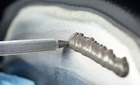 Henkel epoxy cold rebuild