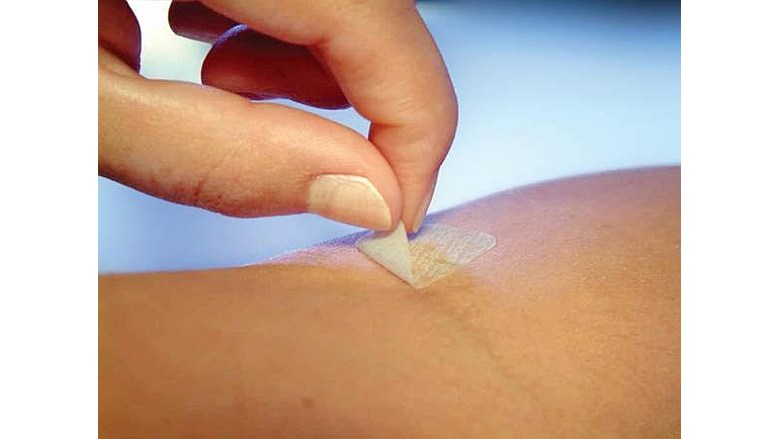 Image of DuPont's Soft Skin Adhesive being removed from an arm.
