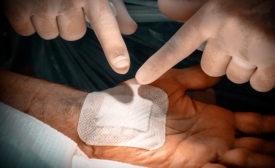 bandage being applied to hand