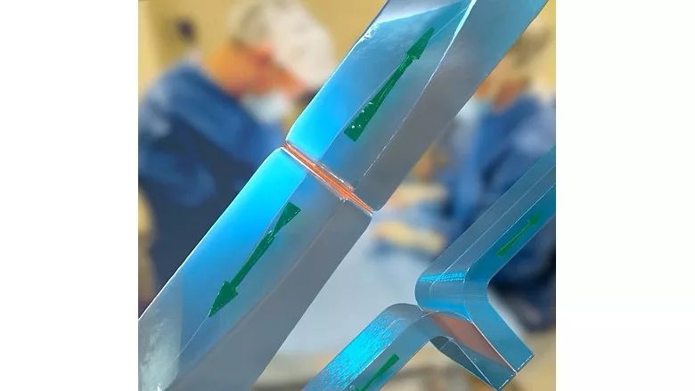 Image of two hydrogels bonded in different ways by thin chitosan films.