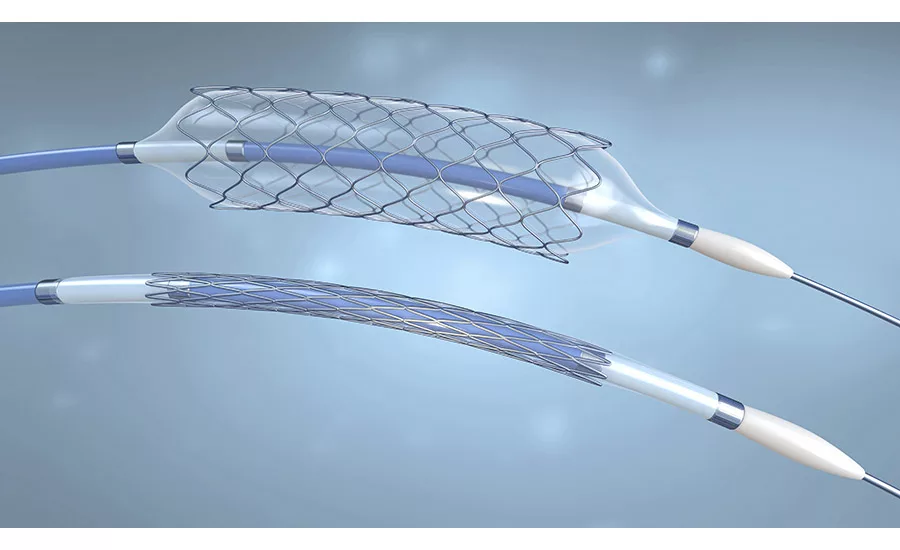 Balloon catheter example