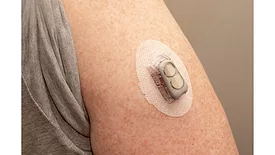 Picture of a medical device on an arm
