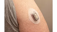 Picture of a medical device on an arm