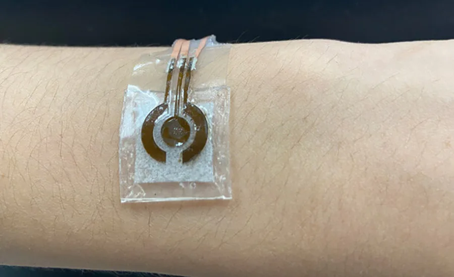 Adhesive Enables Noninvasive Glucose Monitor | Adhesives & Sealants ...
